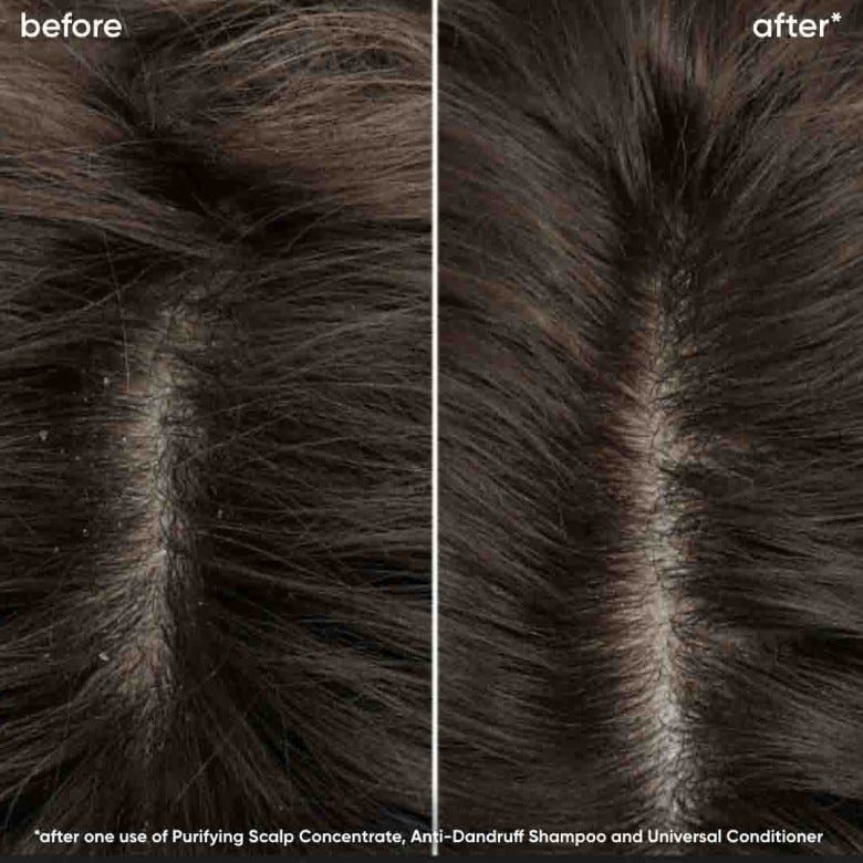 Scalp Sync Universal Conditioner